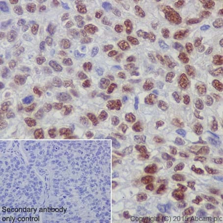 Immunohistochemistry (Formalin/PFA-fixed paraffin-embedded sections) - Anti-Rb (phospho S780) antibody [EPR182(N)] (ab173289), expandable thumbnail