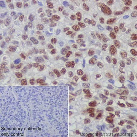 Immunohistochemistry (Formalin/PFA-fixed paraffin-embedded sections) - Anti-Rb (phospho S780) antibody [EPR182(N)] (AB173289)