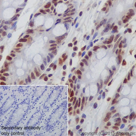 Immunohistochemistry (Formalin/PFA-fixed paraffin-embedded sections) - Anti-Rb (phospho S780) antibody [EPR182(N)] (AB173289), expandable thumbnail