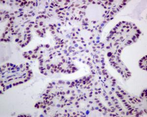 Immunohistochemistry (Formalin/PFA-fixed paraffin-embedded sections) - Anti-Rb (phospho S780) antibody [EPR182(N)] (ab173289), expandable thumbnail