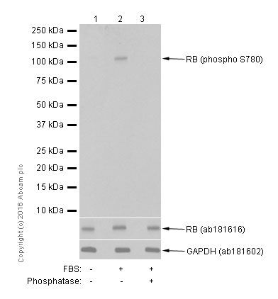 Western blot - Anti-Rb (phospho S780) antibody [EPR182(N)] (AB173289), expandable thumbnail