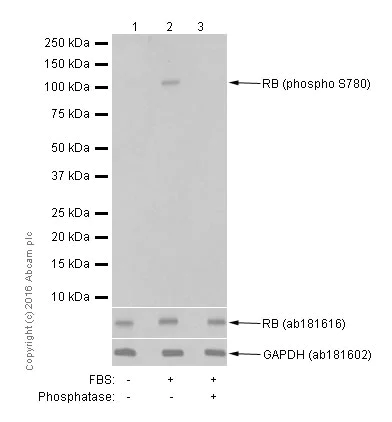 Western blot - Anti-Rb (phospho S780) antibody [EPR182(N)] (AB173289)
