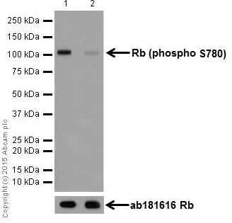 Western blot - Anti-Rb (phospho S780) antibody [EPR182(N)] (AB173289)