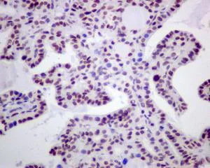 Immunohistochemistry (Formalin/PFA-fixed paraffin-embedded sections) - Anti-Rb (phospho S780) antibody [EPR182(N)] - BSA and Azide free (AB240174)