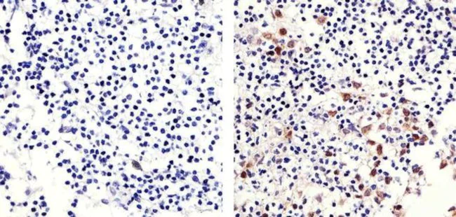 Immunohistochemistry paraffin embedded sections - Anti-Rb (phospho S780) Antibody [RP23040067] (AB313406)