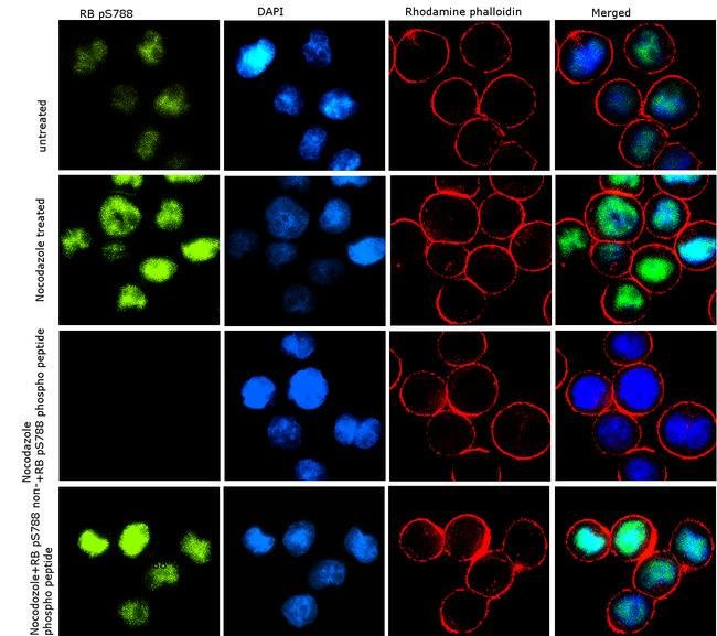 Immunocytochemistry - Anti-Rb (phospho S788) antibody [6HCLC] (AB277775), expandable thumbnail