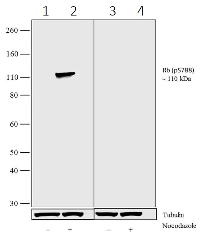 Western blot - Anti-Rb (phospho S788) antibody [6HCLC] (AB277775)