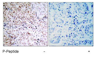 Immunohistochemistry (Formalin/PFA-fixed paraffin-embedded sections) - Anti-Rb (phospho S795) antibody (AB47474)