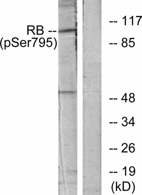 Western blot - Anti-Rb (phospho S795) antibody (AB47474), expandable thumbnail
