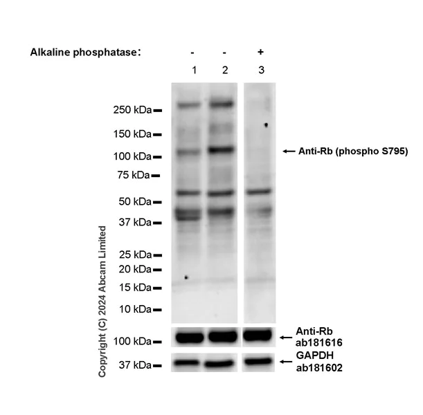 Western blot - Anti-Rb (phospho S795) antibody [EPR28156-6] (AB321974)