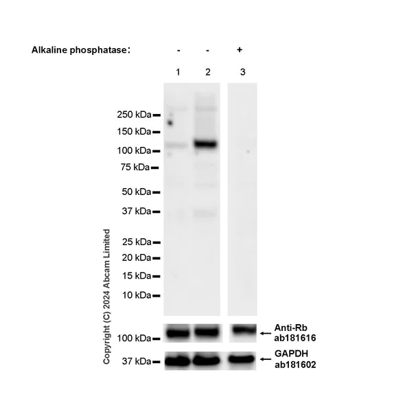 Western blot - Anti-Rb (phospho S795) antibody [EPR28156-6] - BSA and Azide free (AB321975)