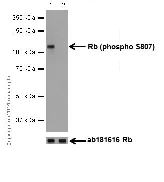 Western blot - Anti-Rb (phospho S807) antibody [EPR17732] (AB184796), expandable thumbnail
