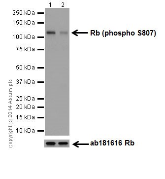 Western blot - Anti-Rb (phospho S807) antibody [EPR17732] (AB184796), expandable thumbnail