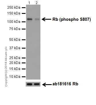 おまとめ【fl537】【aph73】 Human A53T Mutant Alpha Synuclein PFFs (SPR-326)