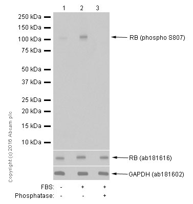 Western blot - Anti-Rb (phospho S807) antibody [EPR17732] (AB184796), expandable thumbnail