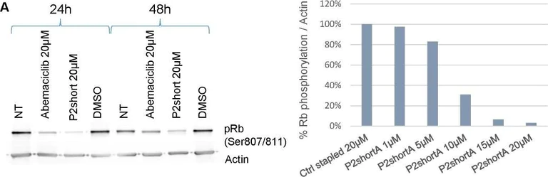 Western blot - Anti-Rb (phospho S807) antibody [EPR17732] (AB184796)