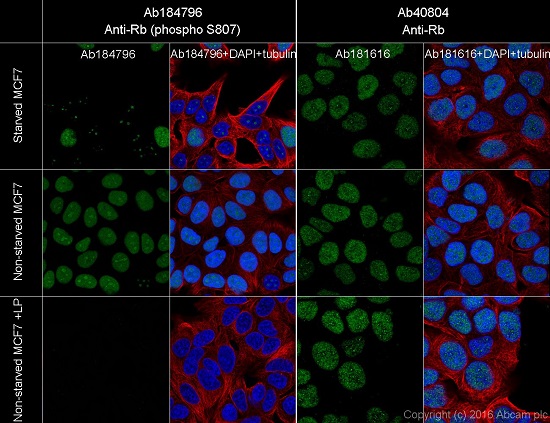 Immunocytochemistry/ Immunofluorescence - Anti-Rb (phospho S807) antibody [EPR17732] - BSA and Azide free (AB215530), expandable thumbnail