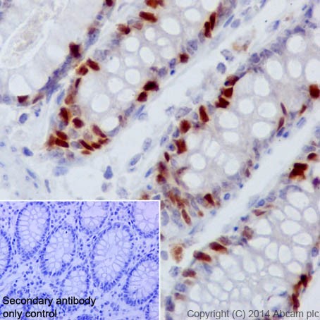 Immunohistochemistry (Formalin/PFA-fixed paraffin-embedded sections) - Anti-Rb (phospho S807) antibody [EPR17732] - BSA and Azide free (AB215530), expandable thumbnail