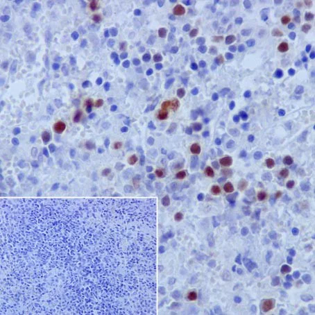 Immunohistochemistry (Formalin/PFA-fixed paraffin-embedded sections) - Anti-Rb (phospho S807) antibody [EPR17732] - BSA and Azide free (AB215530)