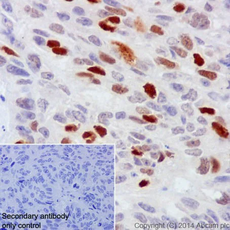 Immunohistochemistry (Formalin/PFA-fixed paraffin-embedded sections) - Anti-Rb (phospho S807) antibody [EPR17732] - BSA and Azide free (AB215530)