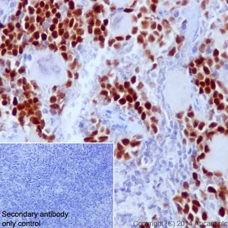 Immunohistochemistry (Formalin/PFA-fixed paraffin-embedded sections) - Anti-Rb (phospho S807) antibody [EPR17732] - BSA and Azide free (AB215530)