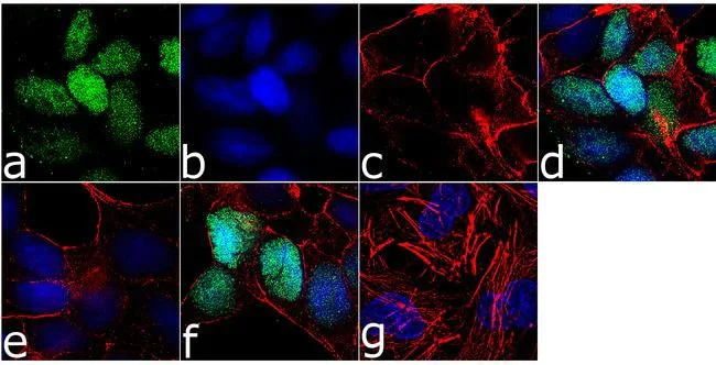 Immunocytochemistry - Anti-Rb (phospho S807 + S811) antibody [13HCLC] (AB277774)
