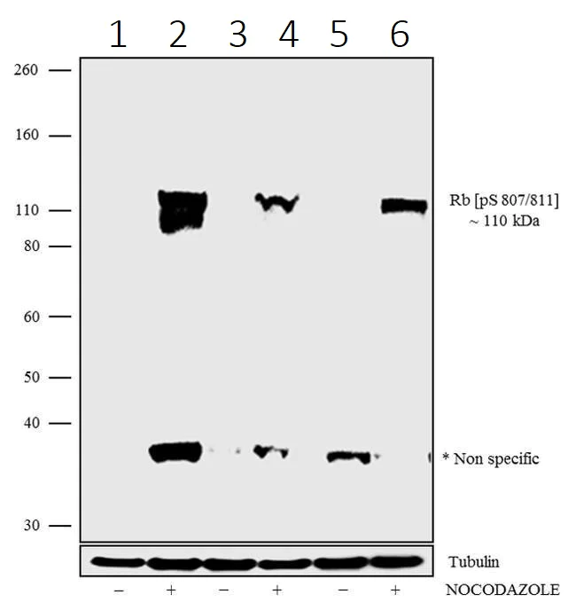 Western blot - Anti-Rb (phospho S807 + S811) antibody [13HCLC] (AB277774)