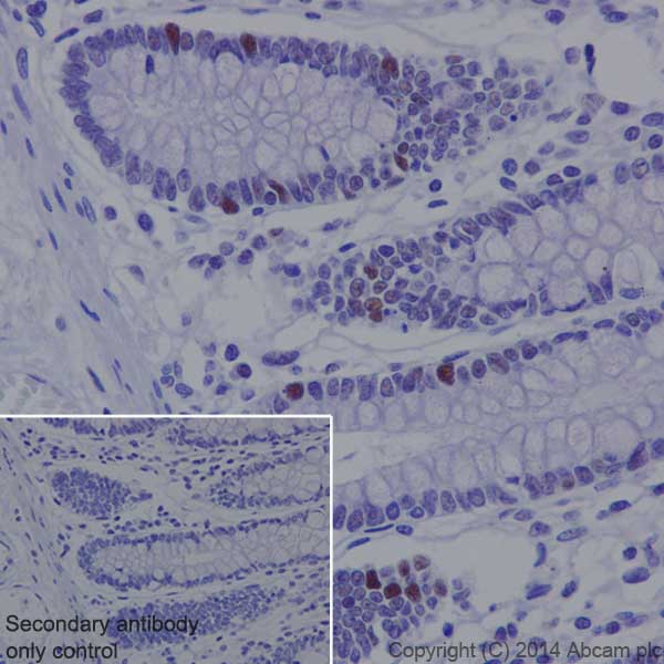 Immunohistochemistry (Formalin/PFA-fixed paraffin-embedded sections) - Anti-Rb (phospho T252) antibody [EPR17733] (AB184797), expandable thumbnail
