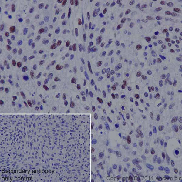 Immunohistochemistry (Formalin/PFA-fixed paraffin-embedded sections) - Anti-Rb (phospho T252) antibody [EPR17733] - BSA and Azide free (AB250779)