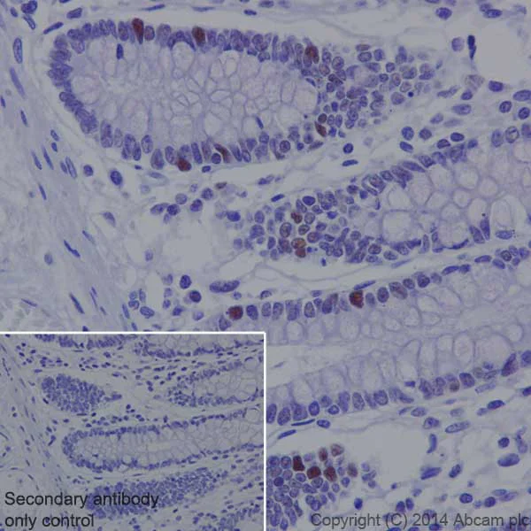 Immunohistochemistry (Formalin/PFA-fixed paraffin-embedded sections) - Anti-Rb (phospho T252) antibody [EPR17733] - BSA and Azide free (AB250779)