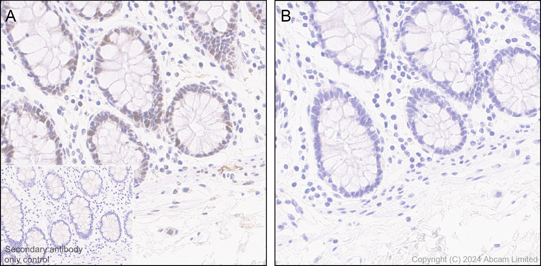 Immunohistochemistry (Formalin/PFA-fixed paraffin-embedded sections) - Anti-Rb (phospho T252 + T356 + S608 + S780 + S807) antibody [RM1144] (ab320747), expandable thumbnail