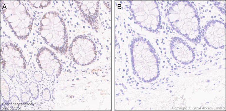 Immunohistochemistry (Formalin/PFA-fixed paraffin-embedded sections) - Anti-Rb (phospho T252 + T356 + S608 + S780 + S807) antibody [RM1144] (AB320747)
