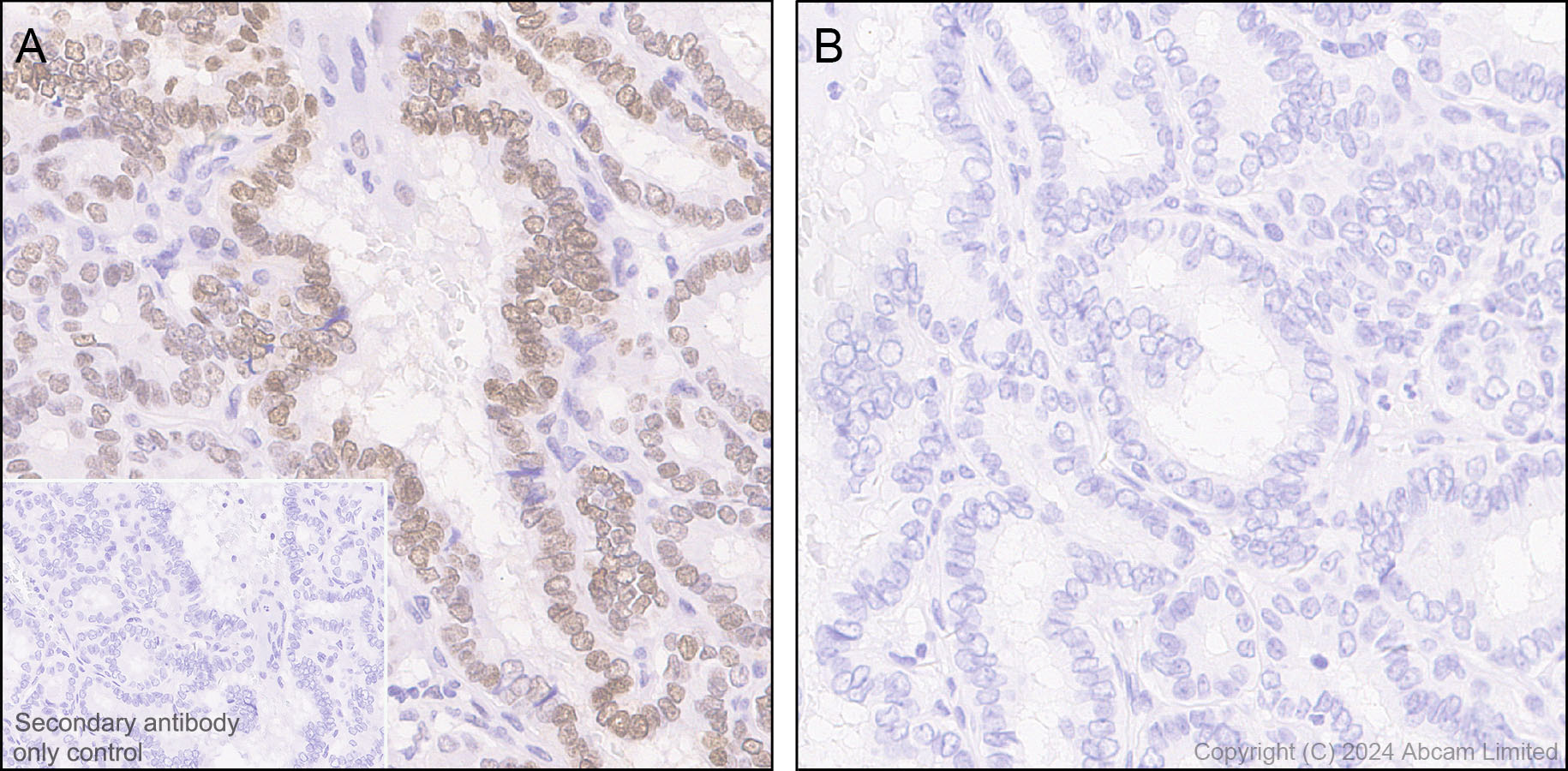 Immunohistochemistry (Formalin/PFA-fixed paraffin-embedded sections) - Anti-Rb (phospho T252 + T356 + S608 + S780 + S807) antibody [RM1144] (ab320747), expandable thumbnail