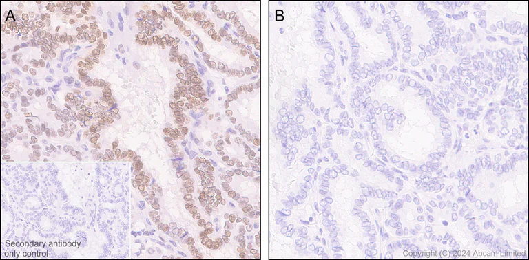 Immunohistochemistry (Formalin/PFA-fixed paraffin-embedded sections) - Anti-Rb (phospho T252 + T356 + S608 + S780 + S807) antibody [RM1144] (AB320747)