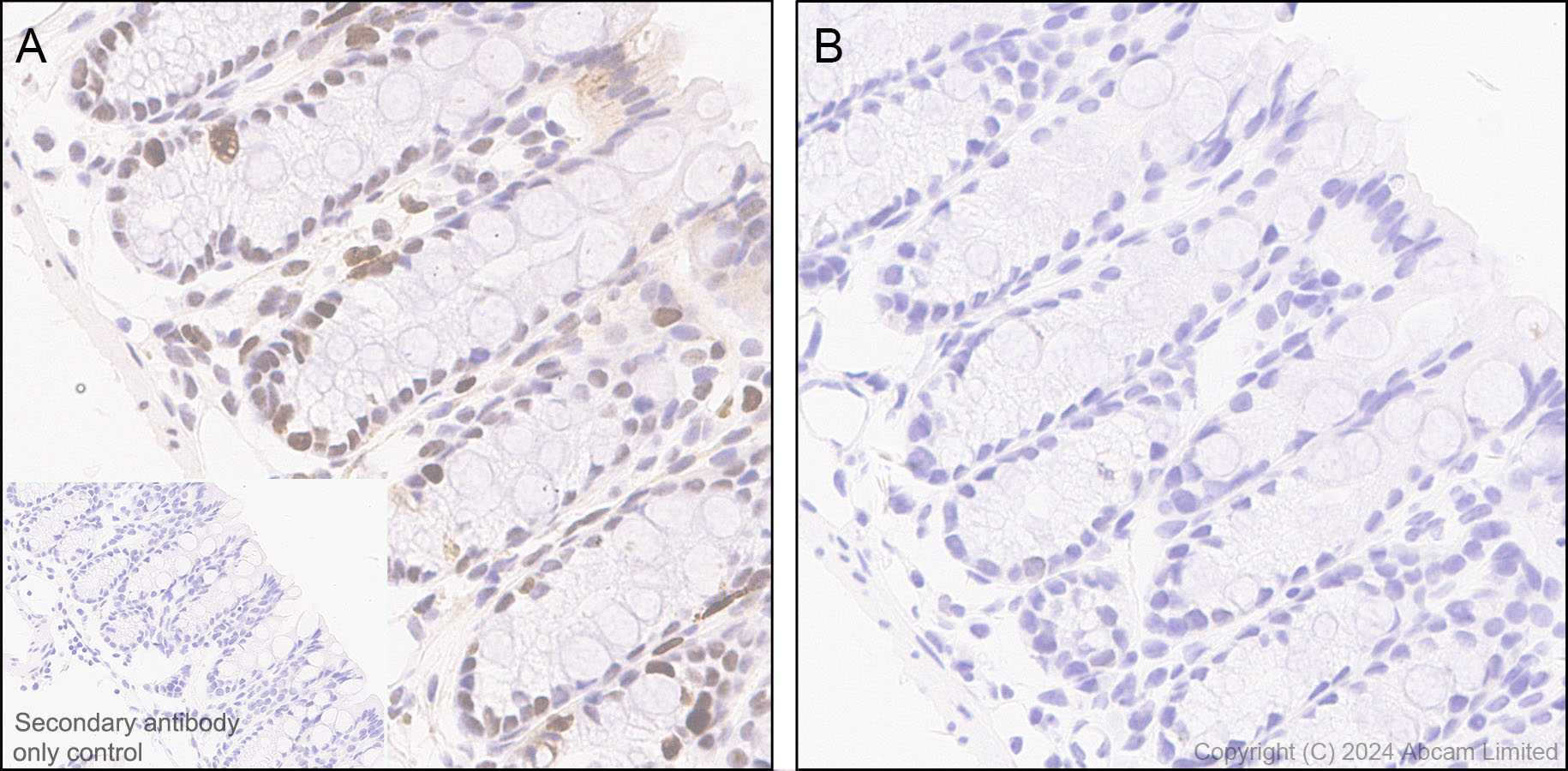 Immunohistochemistry (Formalin/PFA-fixed paraffin-embedded sections) - Anti-Rb (phospho T252 + T356 + S608 + S780 + S807) antibody [RM1144] (ab320747), expandable thumbnail