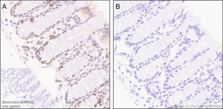 Immunohistochemistry (Formalin/PFA-fixed paraffin-embedded sections) - Anti-Rb (phospho T252 + T356 + S608 + S780 + S807) antibody [RM1144] (AB320747)