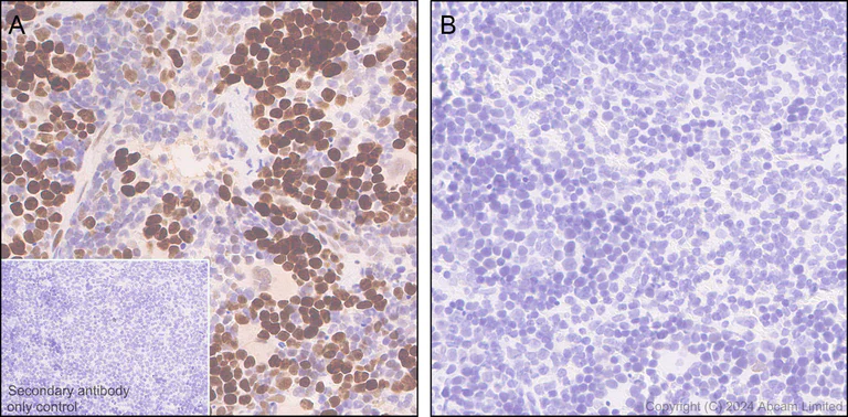 Immunohistochemistry (Formalin/PFA-fixed paraffin-embedded sections) - Anti-Rb (phospho T252 + T356 + S608 + S780 + S807) antibody [RM1144] (AB320747)