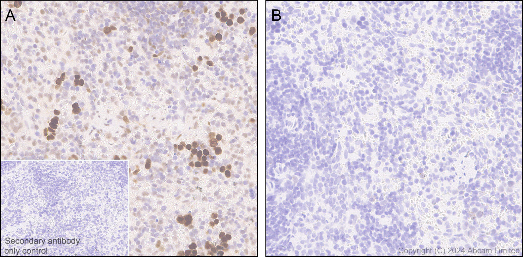 Immunohistochemistry (Formalin/PFA-fixed paraffin-embedded sections) - Anti-Rb (phospho T252 + T356 + S608 + S780 + S807) antibody [RM1144] (AB320747), expandable thumbnail