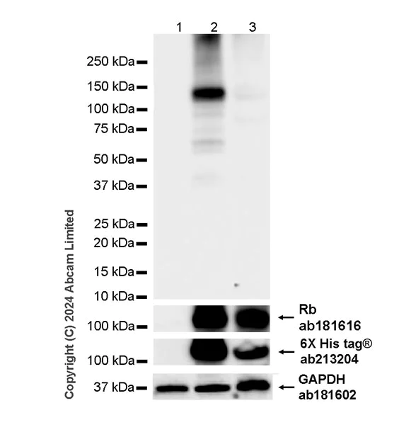 Western blot - Anti-Rb (phospho T252 + T356 + S608 + S780 + S807) antibody [RM1144] (AB320747)