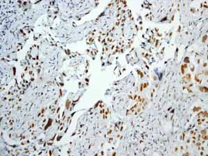 Immunohistochemistry (Formalin/PFA-fixed paraffin-embedded sections) - Anti-Rb (phospho T356) antibody [EPR2153AY] (AB76298)
