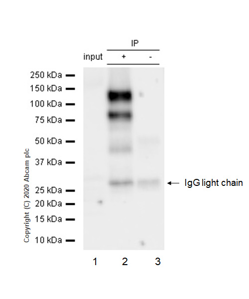 Immunoprecipitation - Anti-Rb (phospho T356) antibody [EPR2153AY] (AB76298), expandable thumbnail