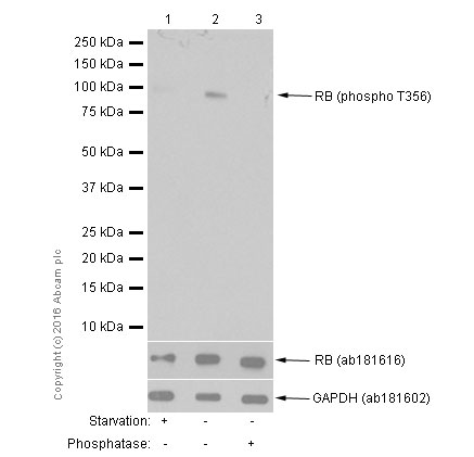 Western blot - Anti-Rb (phospho T356) antibody [EPR2153AY] (AB76298), expandable thumbnail