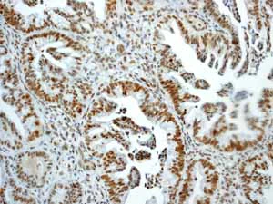 Immunohistochemistry (Formalin/PFA-fixed paraffin-embedded sections) - Anti-Rb (phospho T356) antibody [EPR2153AY] - BSA and Azide free (AB247461)