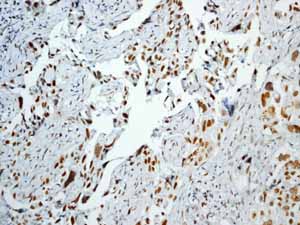 Immunohistochemistry (Formalin/PFA-fixed paraffin-embedded sections) - Anti-Rb (phospho T356) antibody [EPR2153AY] - BSA and Azide free (AB247461), expandable thumbnail