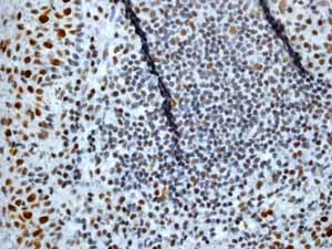 Immunohistochemistry (Formalin/PFA-fixed paraffin-embedded sections) - Anti-Rb (phospho T356) antibody [EPR2153AY] - BSA and Azide free (ab247461), expandable thumbnail