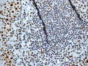 Immunohistochemistry (Formalin/PFA-fixed paraffin-embedded sections) - Anti-Rb (phospho T356) antibody [EPR2153AY] - BSA and Azide free (AB247461)