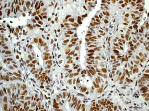 Immunohistochemistry (Formalin/PFA-fixed paraffin-embedded sections) - Anti-Rb (phospho T356) antibody [EPR2153AY] - BSA and Azide free (AB247461), expandable thumbnail