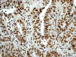 Immunohistochemistry (Formalin/PFA-fixed paraffin-embedded sections) - Anti-Rb (phospho T356) antibody [EPR2153AY] - BSA and Azide free (AB247461)