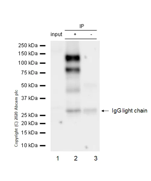 Immunoprecipitation - Anti-Rb (phospho T356) antibody [EPR2153AY] - BSA and Azide free (AB247461)