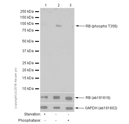 Western blot - Anti-Rb (phospho T356) antibody [EPR2153AY] - BSA and Azide free (AB247461)